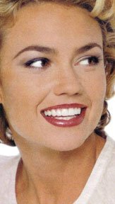 Teeth Whitening